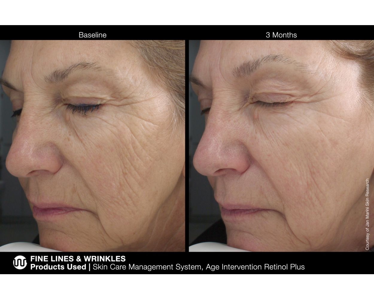Jan Marini Age Intervention® Retinol Plus