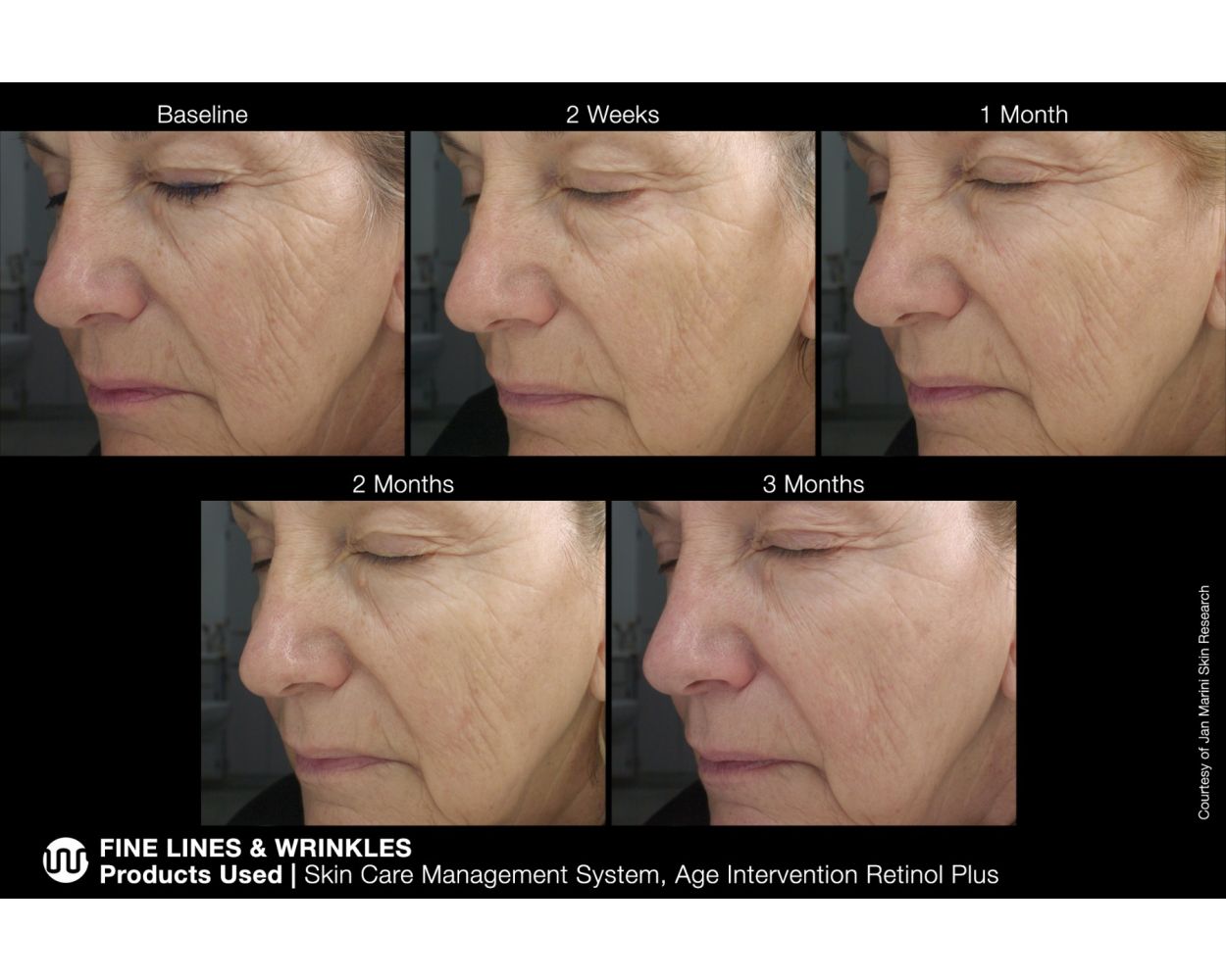 Jan Marini Age Intervention® Retinol Plus