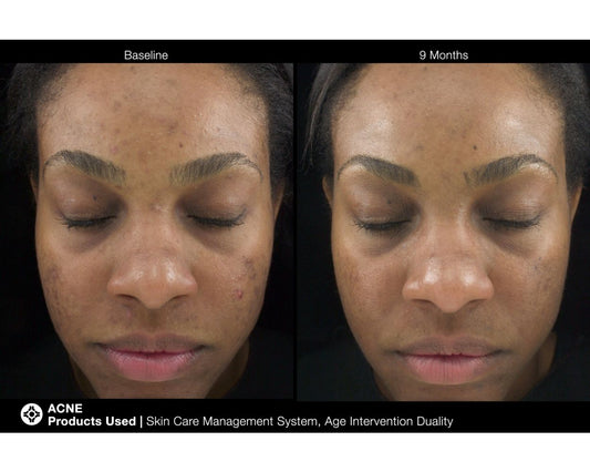 Jan Marini Age Intervention® Duality™